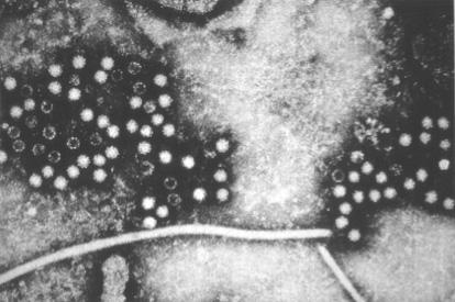 Electron micrograph of hepatitis E virus